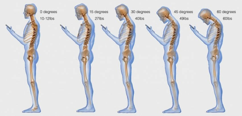 Κοιτάζοντας λάθος το κινητό ή το tablet, ασκούμε πίεση 27 κιλών στον αυχένα!